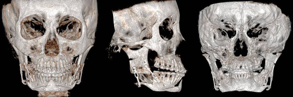 61C65915 5362 4223 B9DA C59F20A3E96F