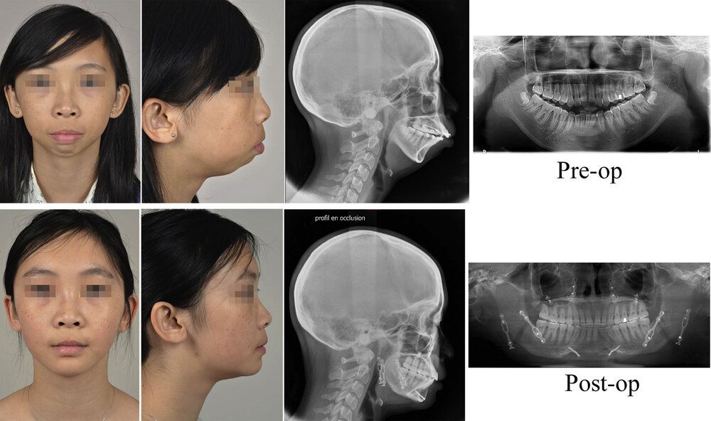 1F5E2AED 6D9C 431B 9B44 3DC7D048AD67