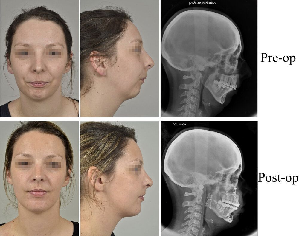 78C8F735 630A 4920 B75C 937C63915CAE