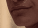 Chin philtrum