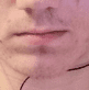 CHIN PHILTRUM THEORY