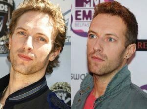 Coldplay5