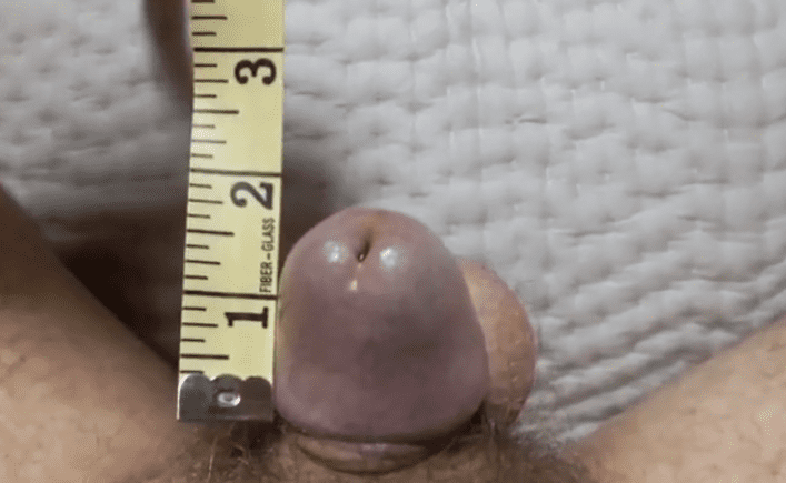 Capturar