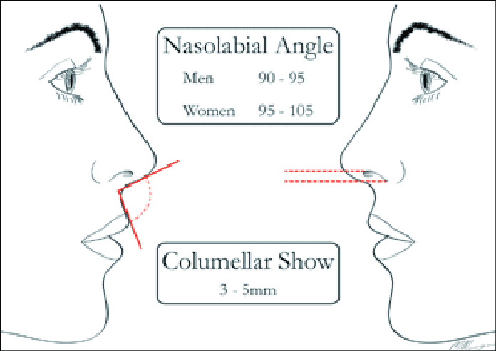 Left nasolabial angle in men and women Rightnormal columellar show