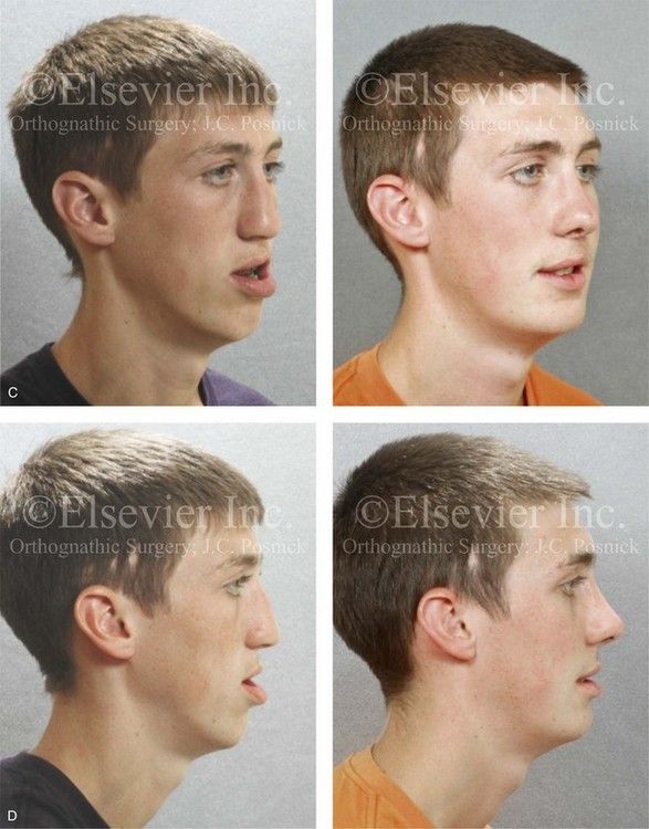 B9781455726981000174 f017 014cd 9781455726981