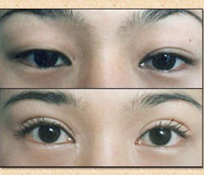 Asia eyes2 big