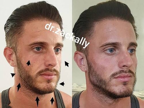 images - 2020-04-14T164608.833.jpeg