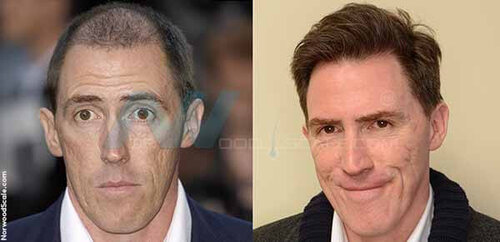 Rob-Brydon.jpg