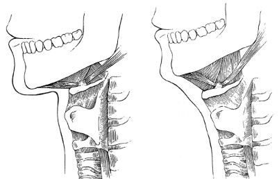 Bailey hyoid copy