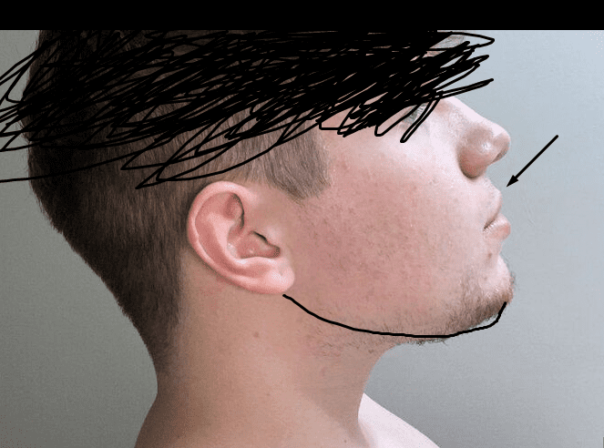 Average forward growth