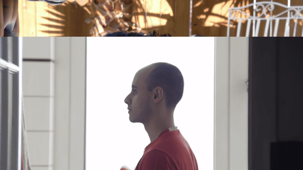 BALD1