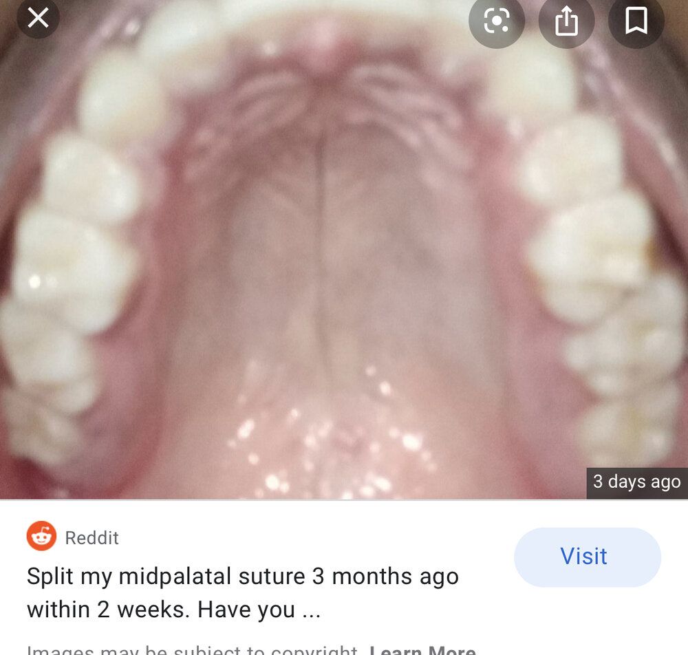 54C46AAA C8D8 4583 AA13 F5059181D5A7
