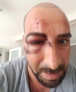 0x0 turkish man severely beaten by far right group in belgium 1496047451874