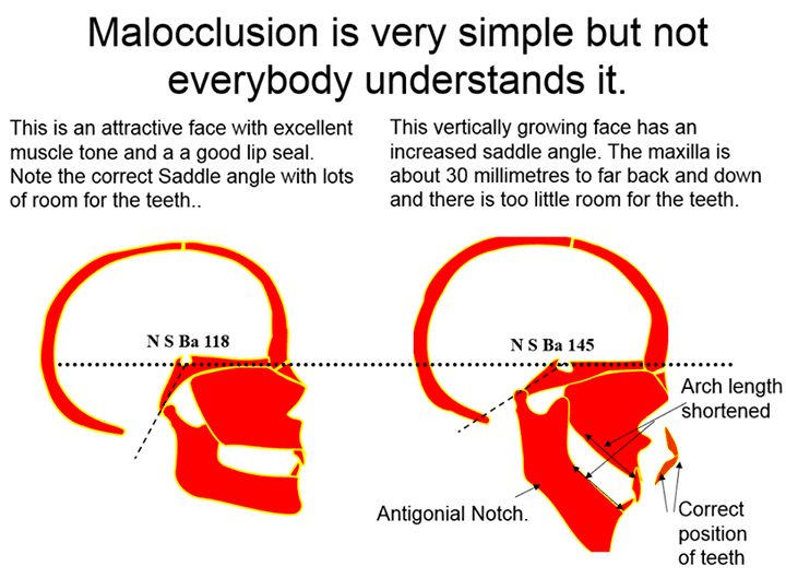 1537715905 9956328220957144882611552659600546067540n