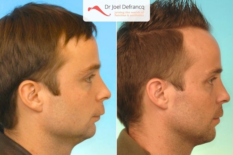 Dr Joel Defrancq 1444362792004372900 3230