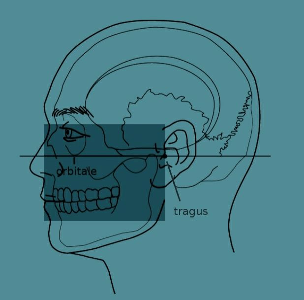 Image0 13 20200510112827483