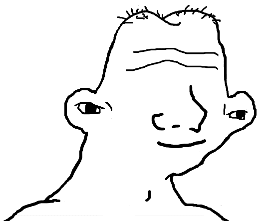Brainlet wide eyes