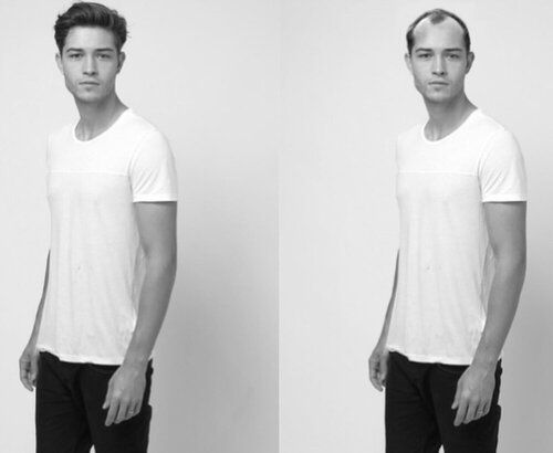 Chico hair