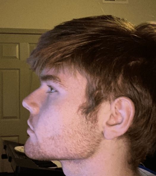 202005127619181196098801810