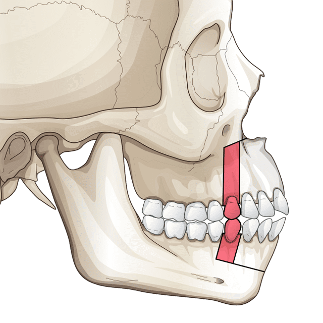 Img twojaw threejaw 2 1