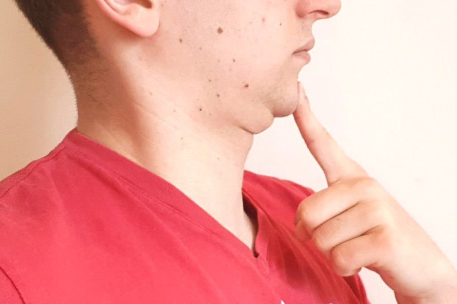 Chin tucking 1