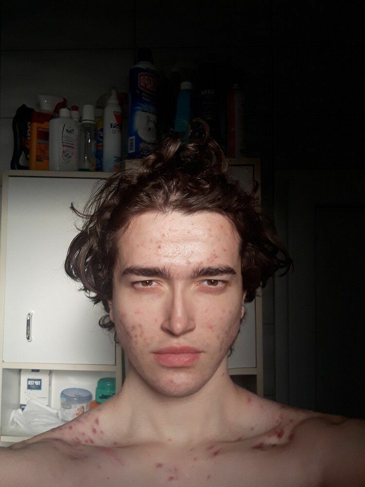 2020051621720744893792339