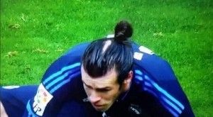 Bald patch bale