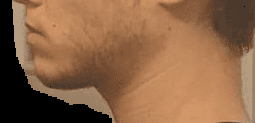 Ch