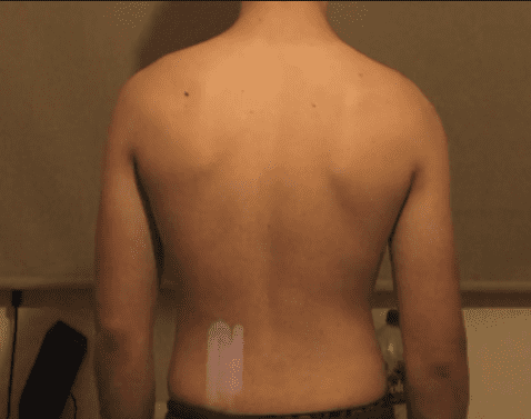 Me back
