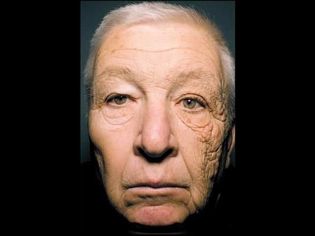 Trucker damage face web