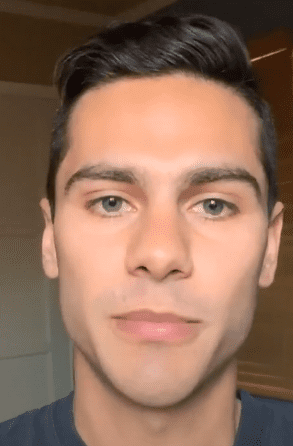 Jawlinefiller