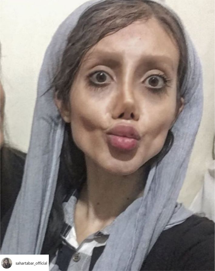 114