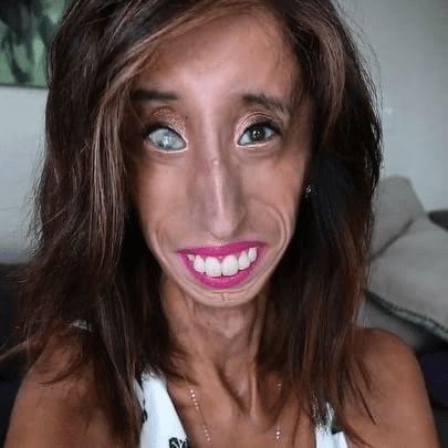 00