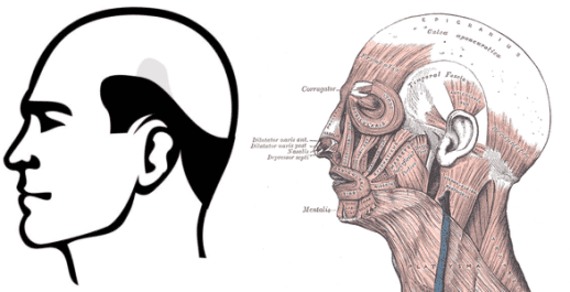 Norwood 7 left galea right