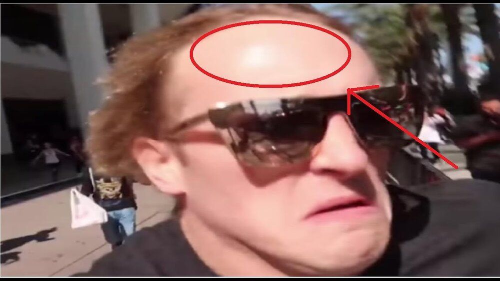 Maxresdefault