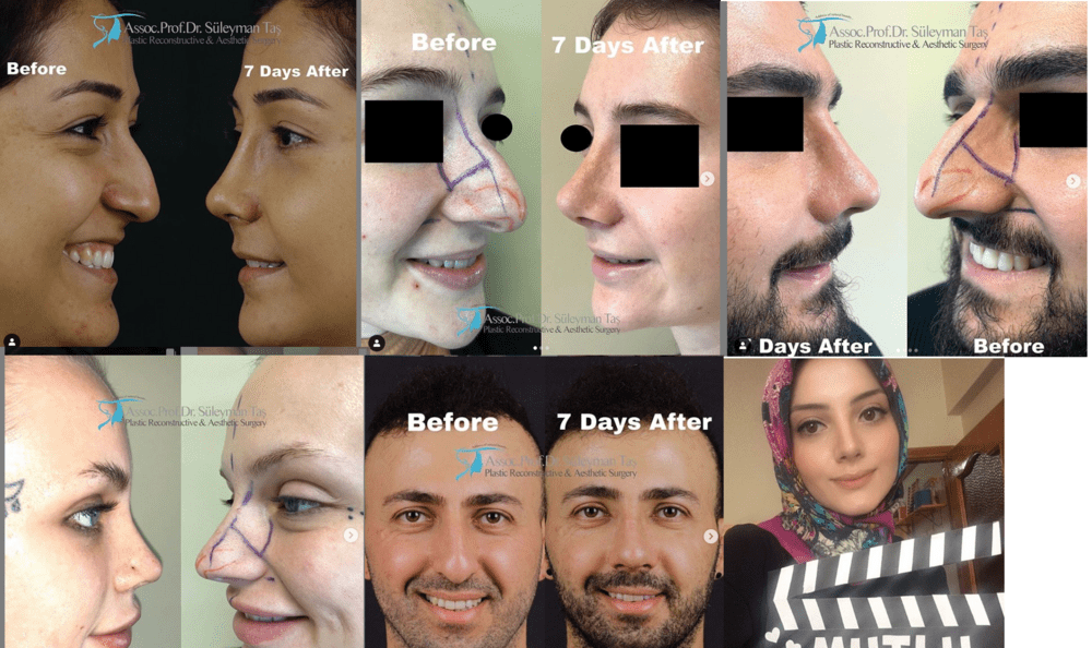 Dr suleyman tas insane results
