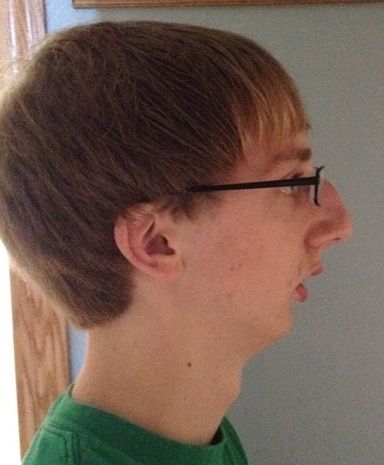 Side profile 2
