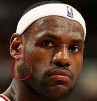 YOO LEBRON looks LIKE HE HAS TUMOR GROWING on JAW AGAIN using his ...