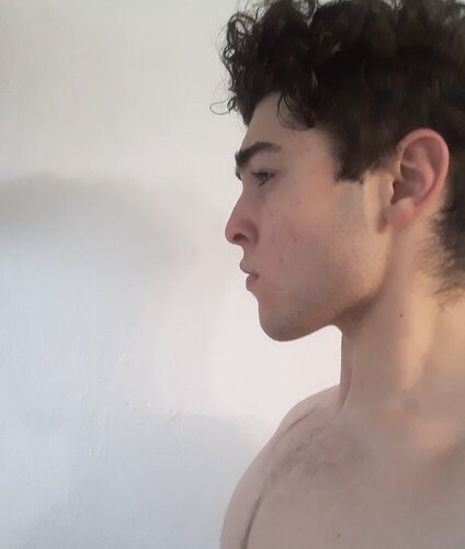 202004288544972830142038815