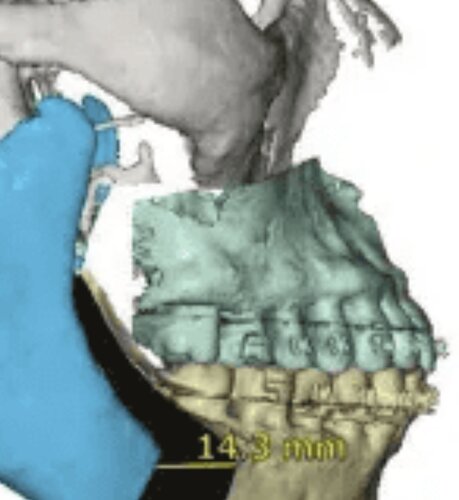 Screenshot 20200507 230303  01  01