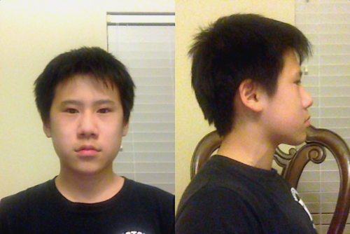 TeenAmIUgly