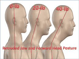 08 44 52 NeckPosture