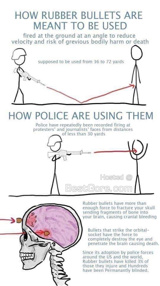 Girl shot forehead rubber bullet george floyd protests infographic