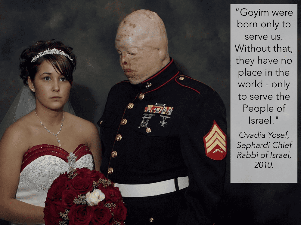 Goyim jewish burnt guy american