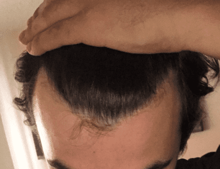 Hair2