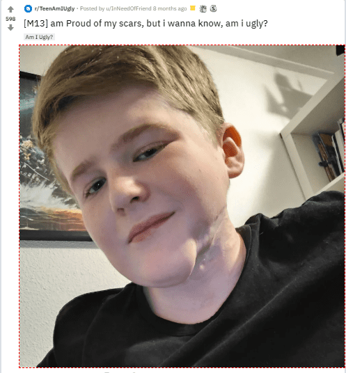 Epicjawline