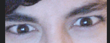 Dramatic squint