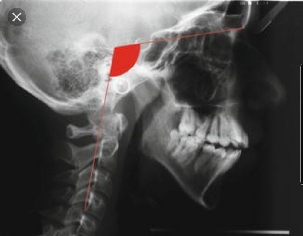 SmartSelect 20200610 191238 Firefox