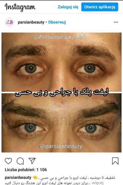 Comment 1590580375V26PKVD56gBOdJwPYlaEGyw400