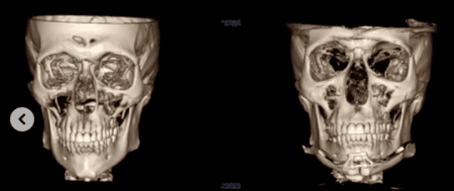 Ct front